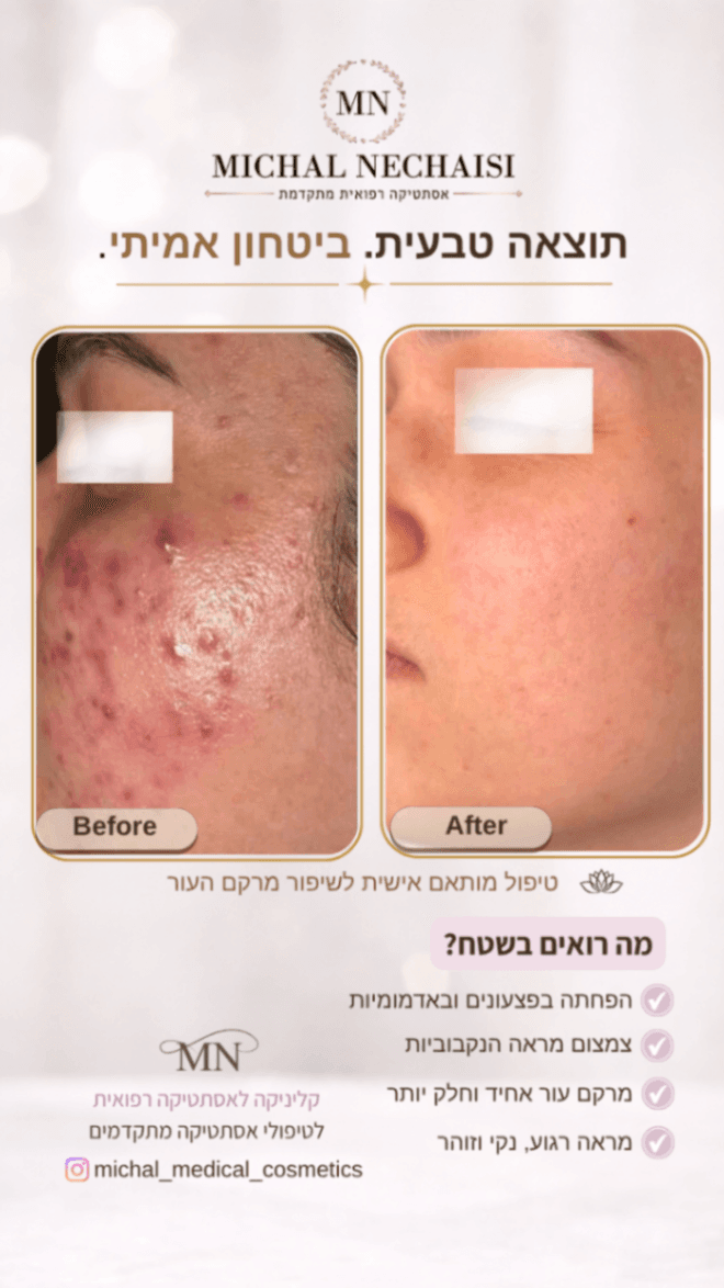 מיכל נחאיסי קליניקה לאסתטיקה רפואית